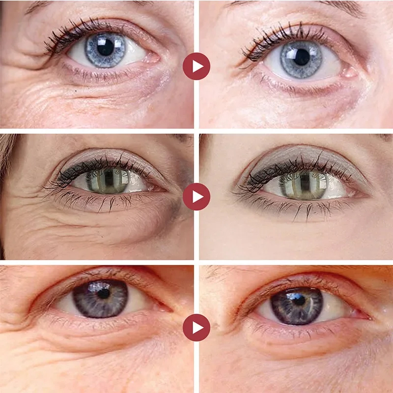 Wrinkle Remove Eyes Patches Fi - Collagen Eye Patch 评论和价格